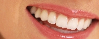 「キレイな歯並び」「白く輝く歯」「美しい笑顔」